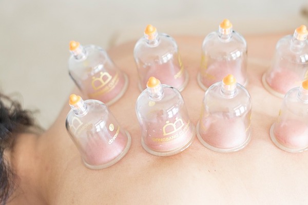 Cupping som supplement